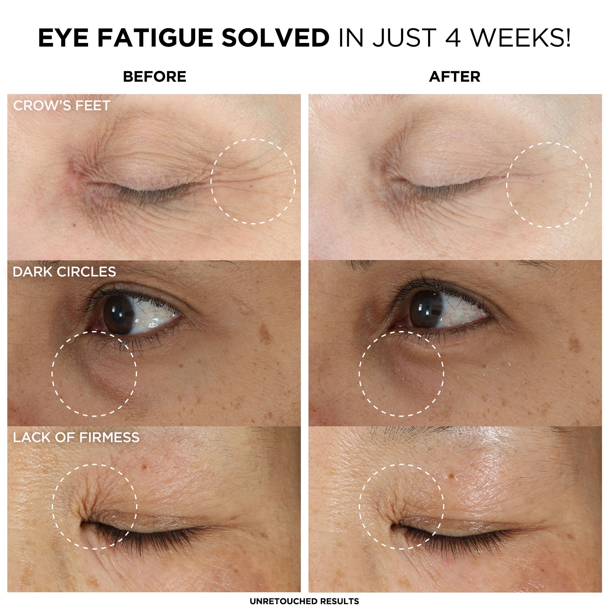 IT Cosmetics Confidence in an Eye Cream, Anti Aging Eye Cream for Dark Circles, Crow's Feet, Lack of Firmness & Dryness, 48HR Hydration with 2% Super Peptide Concentrate, for Day + Night